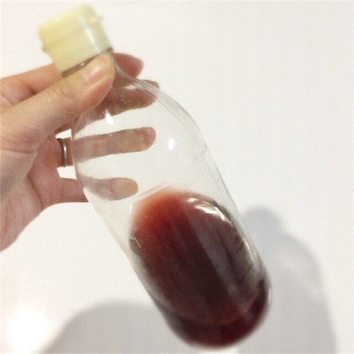 花粉症にもアトピーにもダイエットにも 赤しそジュースのススメ よゆうのよっちゃん