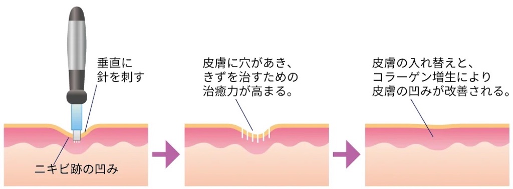 f:id:JUNn:20230113041756j:image