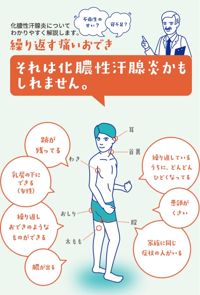 オデキは痔の始まり 映画とバイク 時々 ワンコ