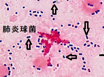 f:id:K88344193:20210220173448j:image