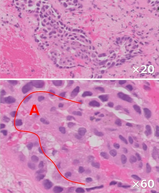 f:id:K88344193:20210227204335j:image