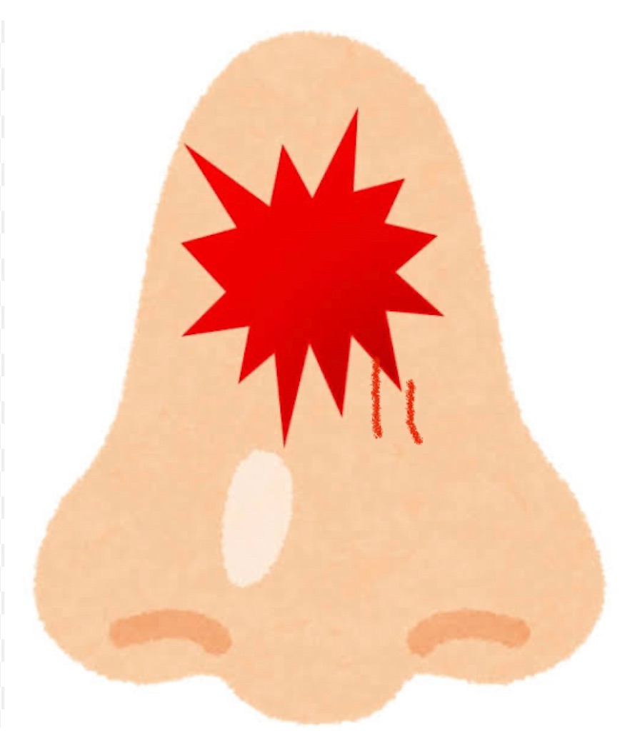 f:id:KANAYOGA:20230612064658j:image