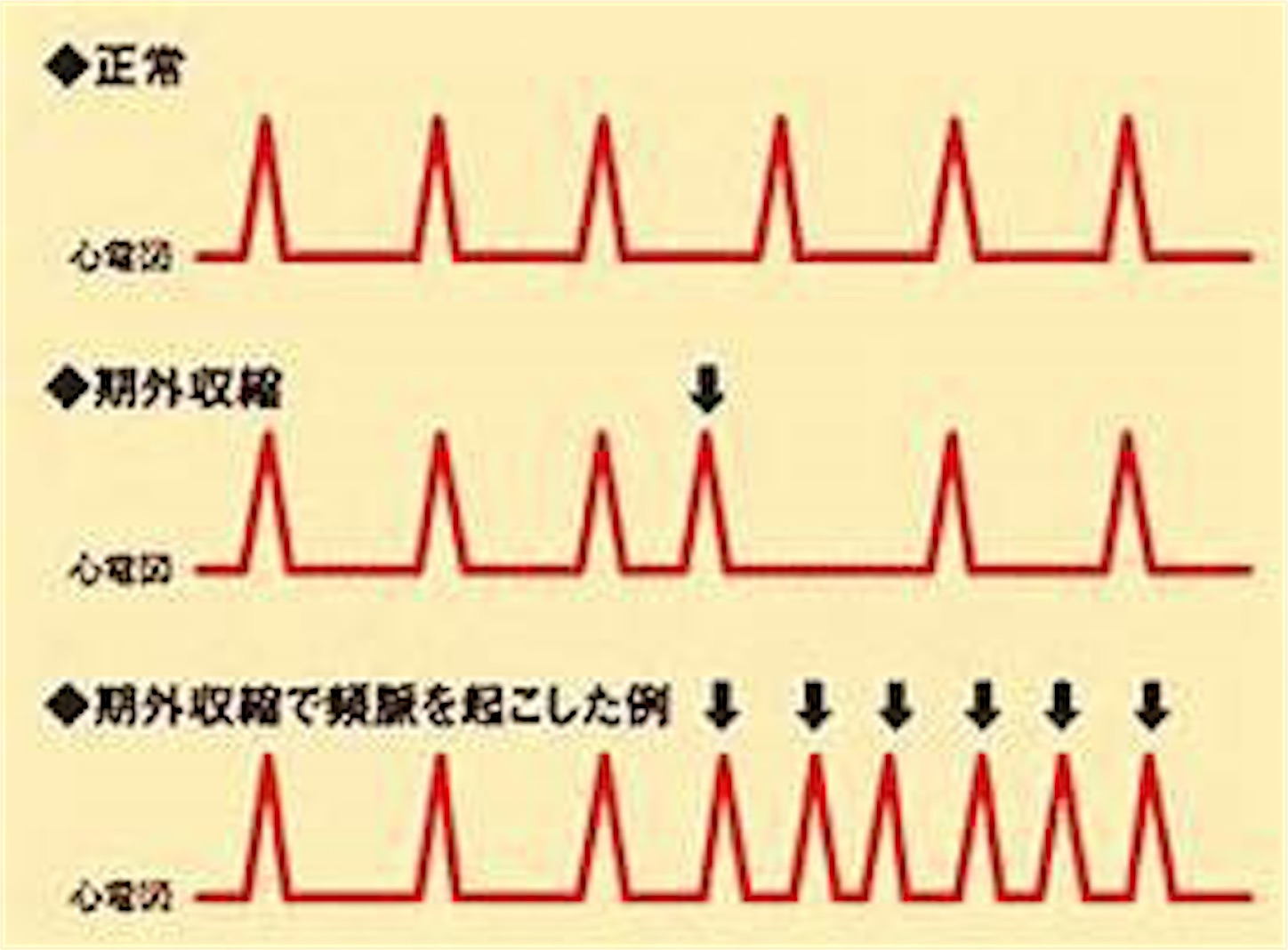 f:id:KAPURIKO:20200905014339j:image