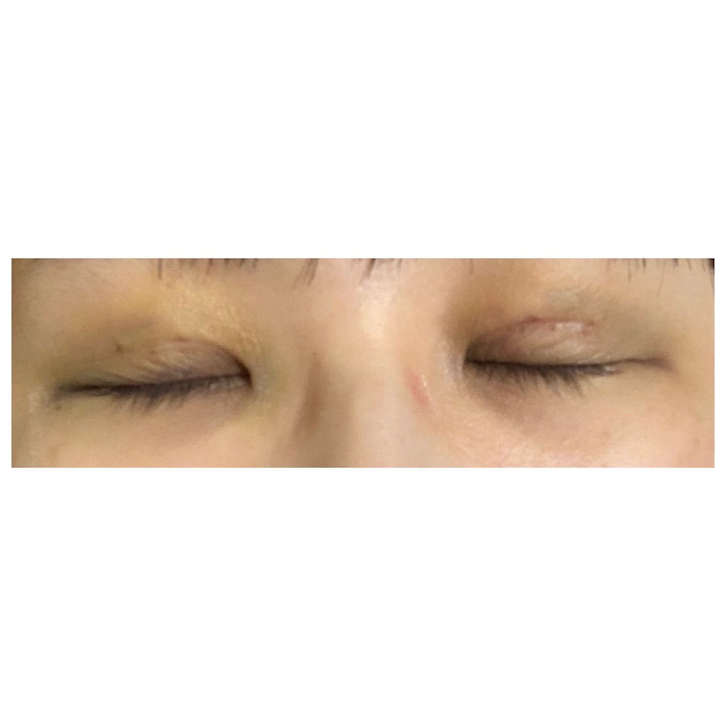 f:id:KAPURIKO:20210131234820j:image f:id:KAPURIKO:20210131234820j:image