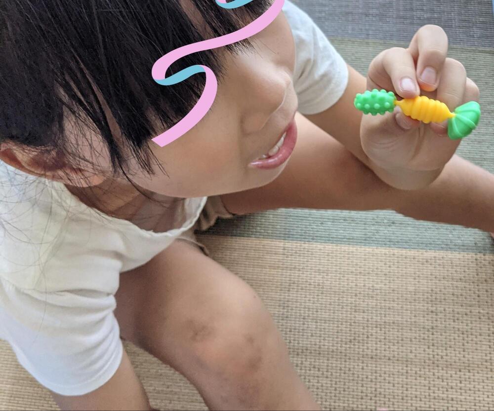 トレクシオ　口コミ