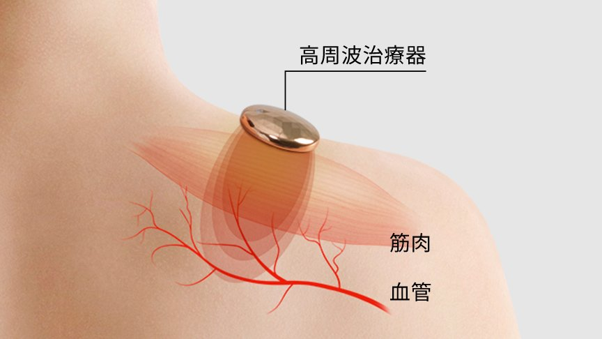 血流を改善し、コリの根本にアプローチ