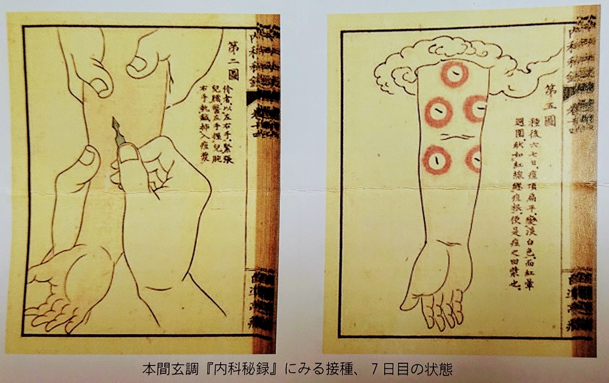 f:id:Kaimotu_Hatuji:20200219203224j:plain