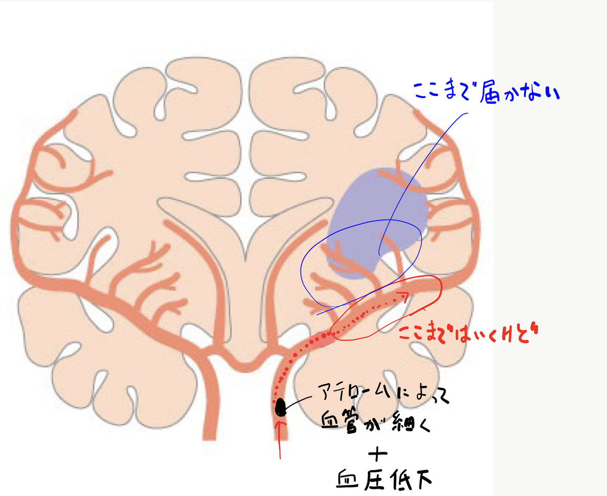 f:id:Katsu13:20190626221942j:plain