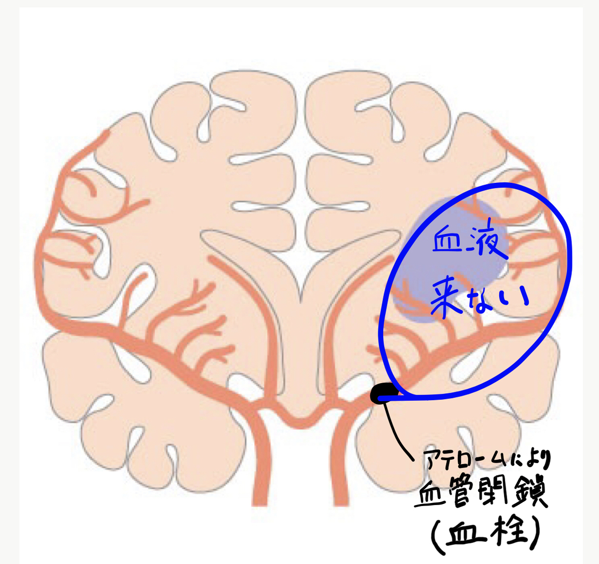 f:id:Katsu13:20190626221952j:plain