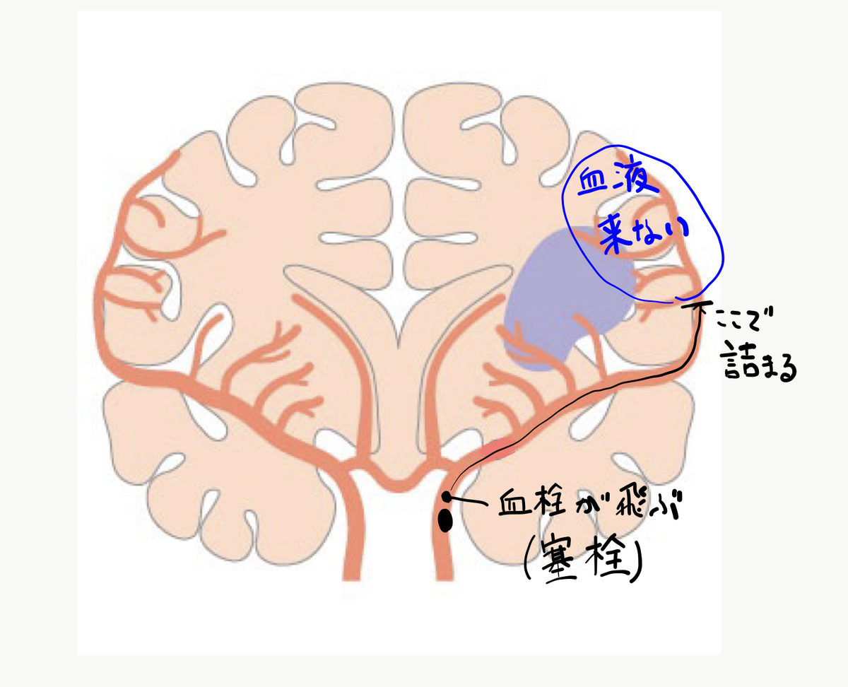 f:id:Katsu13:20190626222034j:plain
