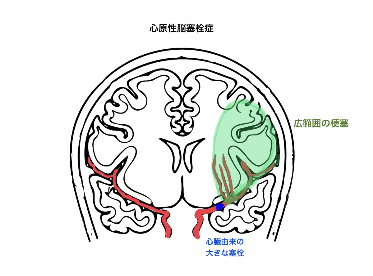 f:id:Katsu13:20190824142308j:plain