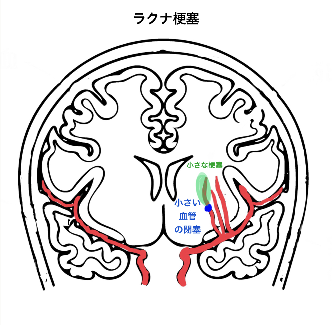 f:id:Katsu13:20190824142520j:plain