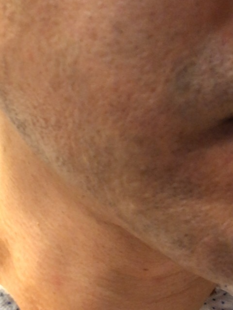 f:id:KeiIto:20180731172421j:plain f:id:KeiIto:20180731172421j:plain