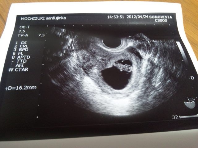 f:id:Lacesis:20120424180111j:image