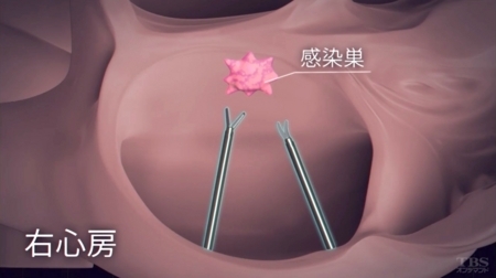 f:id:Leo16:20180527005200j:image:w445