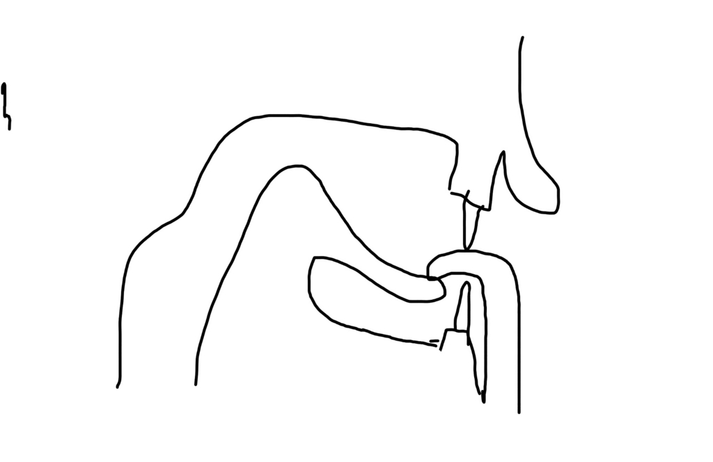f:id:Like6cket:20180717141849j:plain