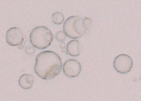 f:id:Limnology:20171130174614j:image