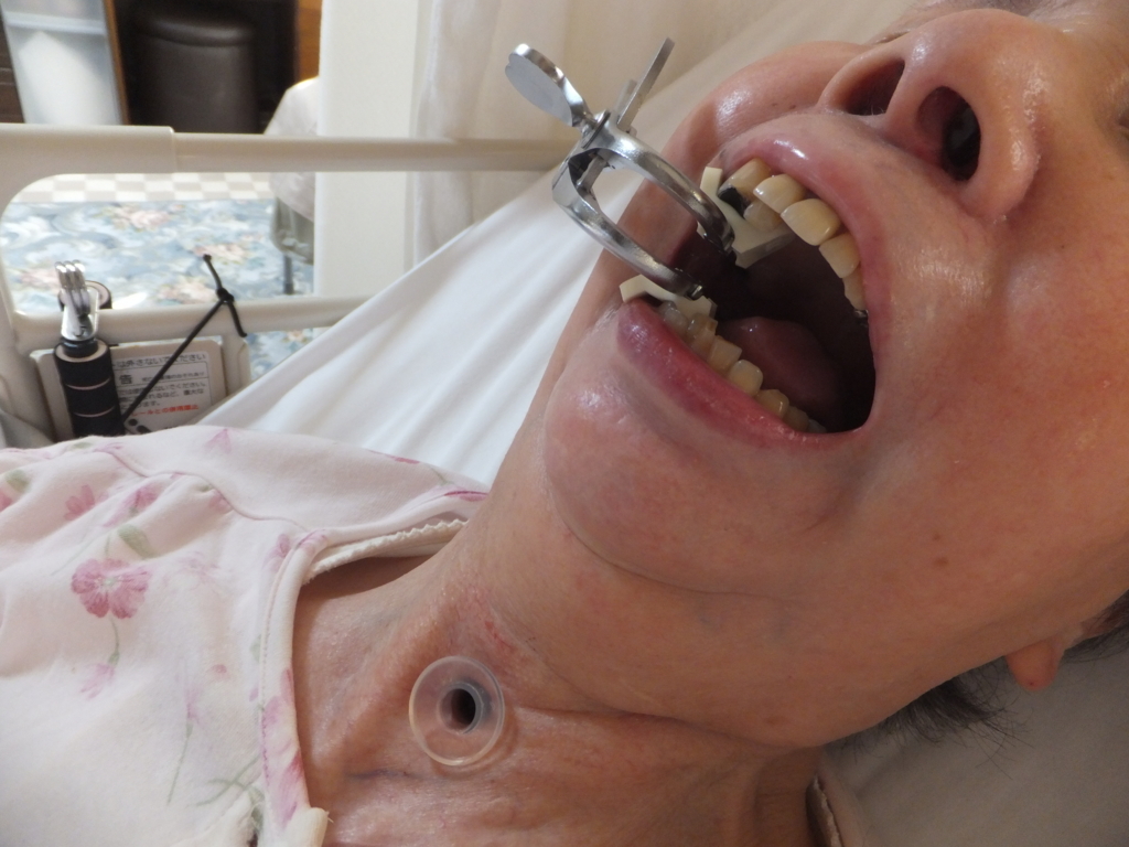 f:id:MAIKALFUJIO:20180417201835j:plain f:id:MAIKALFUJIO:20180417201835j:plain