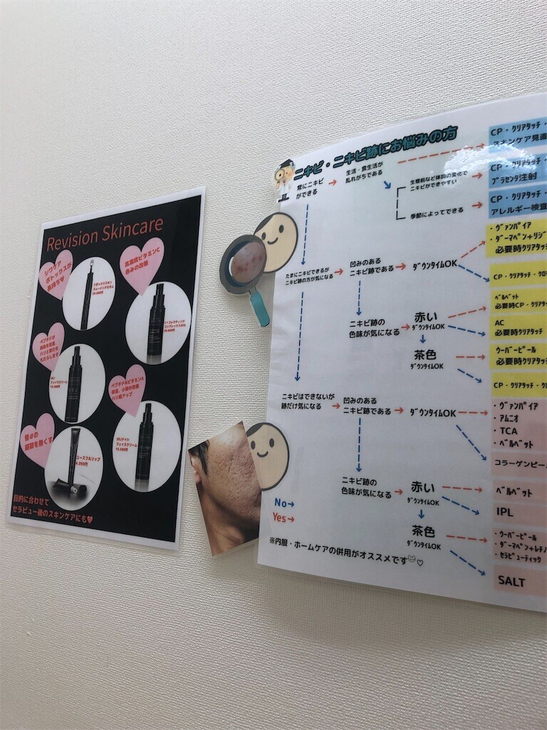 f:id:MARUHOPPE:20230326020952j:image