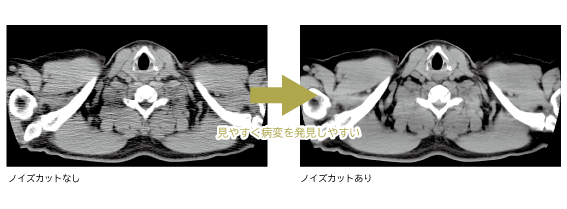 f:id:MM500078:20220108151245p:plain