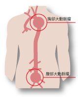 f:id:MM500078:20220129144831p:plain