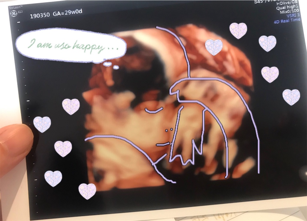 f:id:MOQ3004:20190720000939j:image