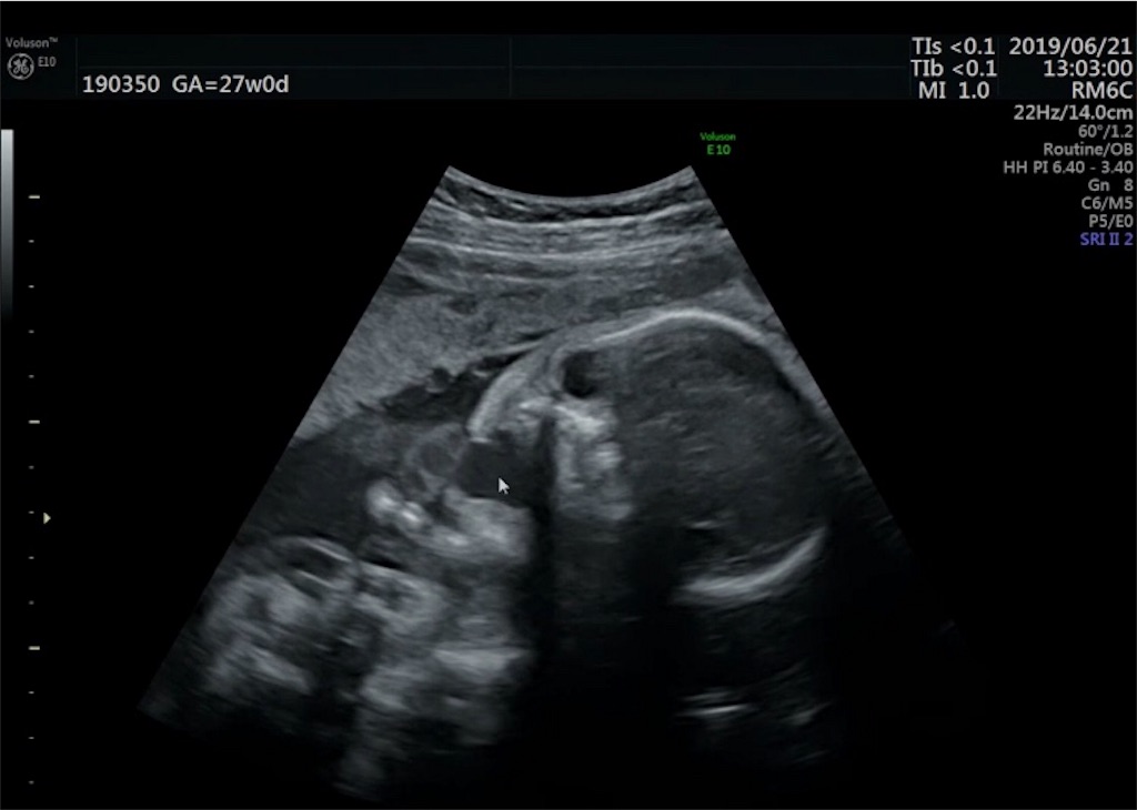 f:id:MOQ3004:20190720021932j:image