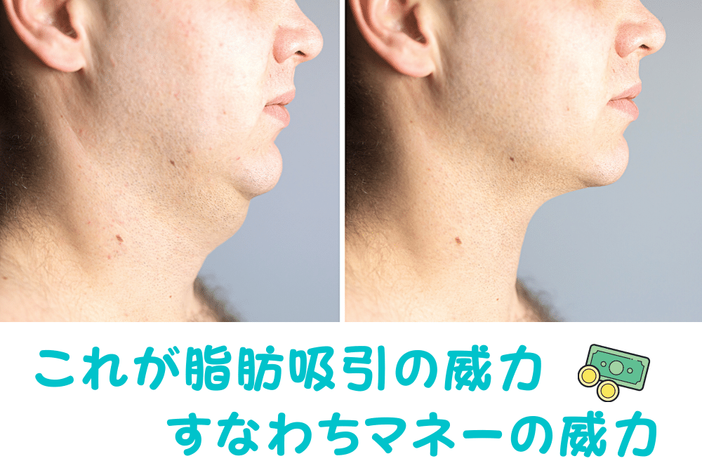 f:id:MORIKO:20210726221309p:plain