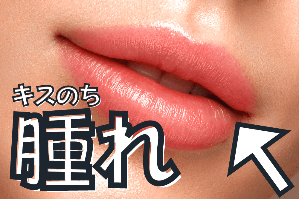 唇が腫れる6つの原因 - 健康百科事典