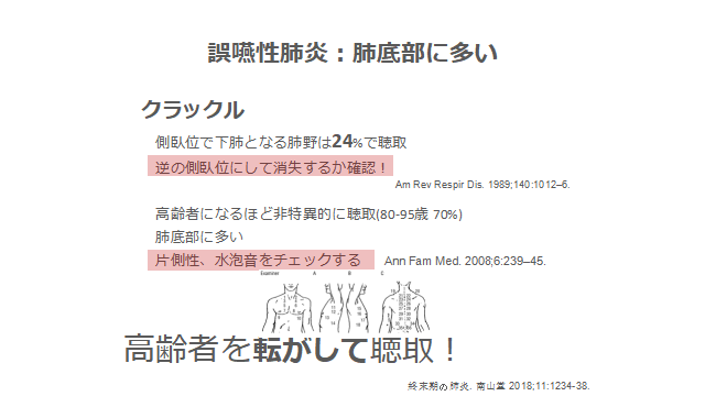 f:id:MOura:20190923015834p:plain