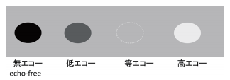 f:id:MOura:20191106231145p:plain