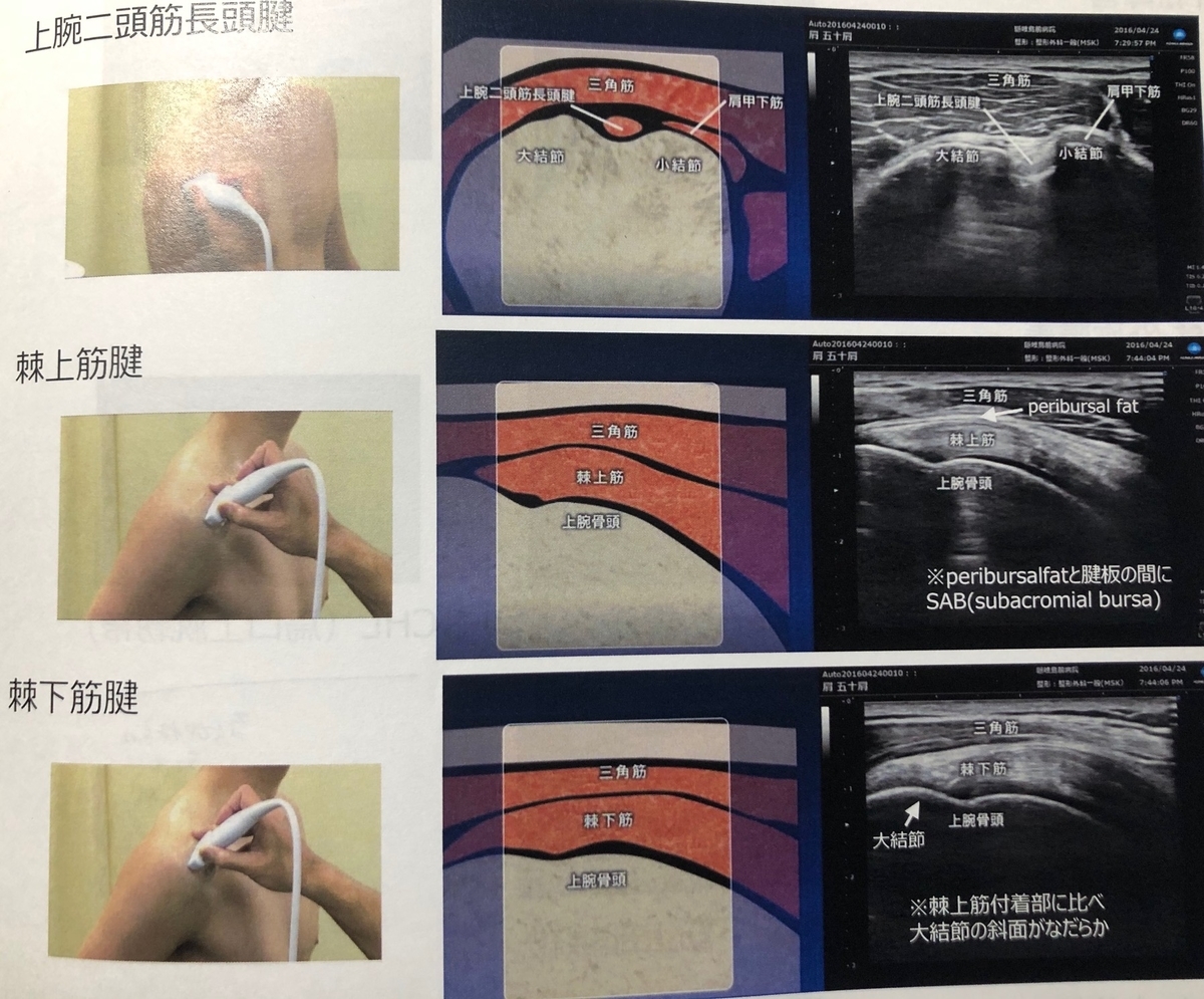 見てわかる「肩の解剖と超音波診断」監修 皆川洋至 DVD