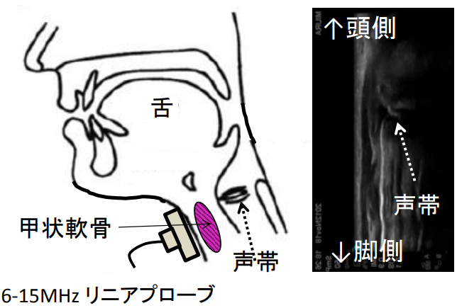 f:id:MOura:20191116012808p:plain