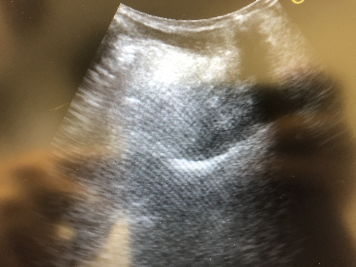 f:id:MOura:20191129014213j:plain