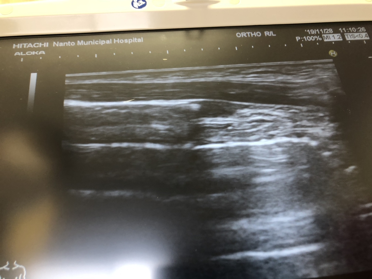 f:id:MOura:20191129014226j:plain
