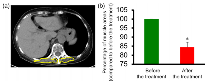 f:id:MOura:20191207140004p:plain