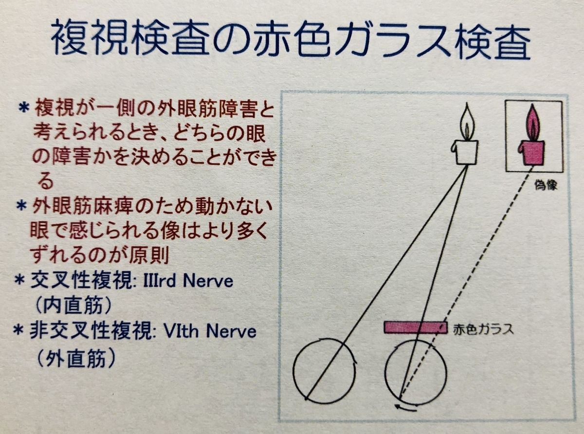 廣瀬源二郎先生の神経内科レクチャーまとめ 南砺の病院家庭医が勉強記録を始めました An Archive Of Medical Articles Summarized By A Family Physician From Nanto Municipal Hospital 廣瀬源二郎先生の神経内科レクチャーまとめ 南砺の病院家庭医が勉強記録を始めました An Archive Of Medical Articles Summarized By A Family Physician From Nanto Municipal Hospital