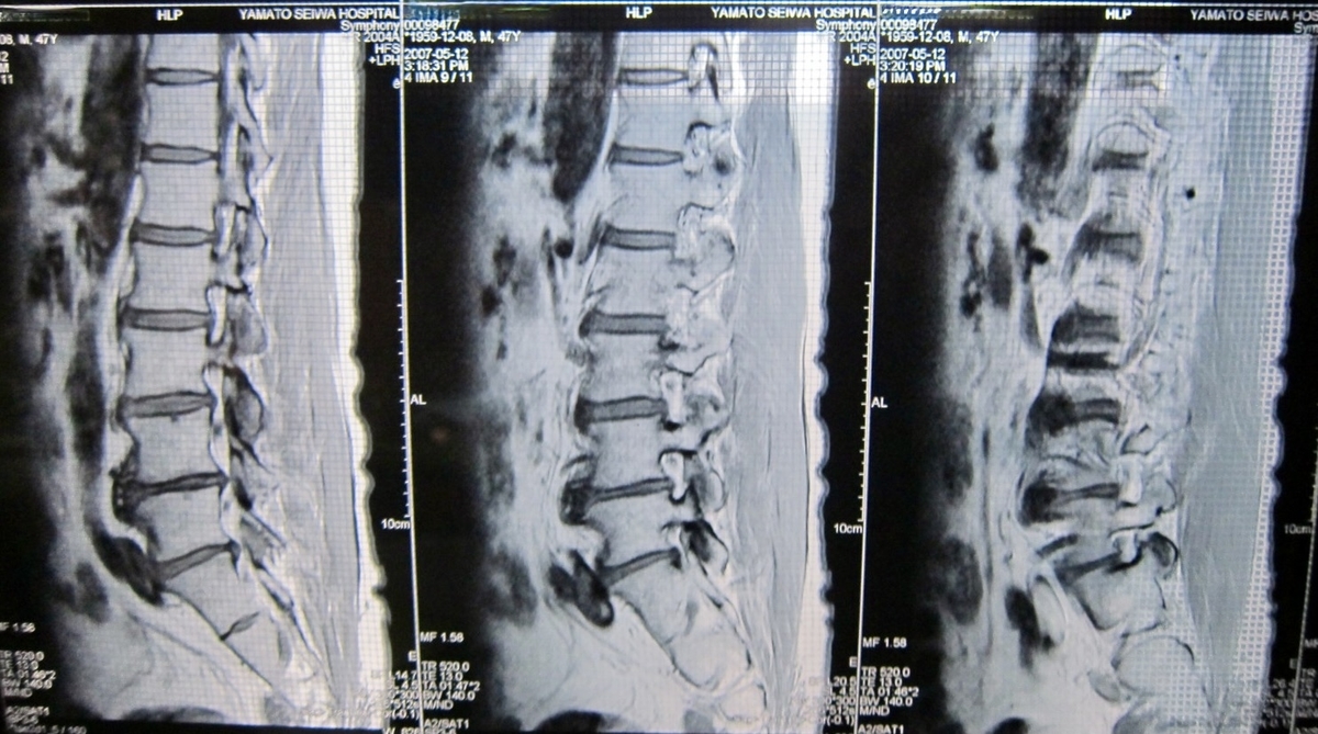 f:id:MacRun:20210912145902j:plain