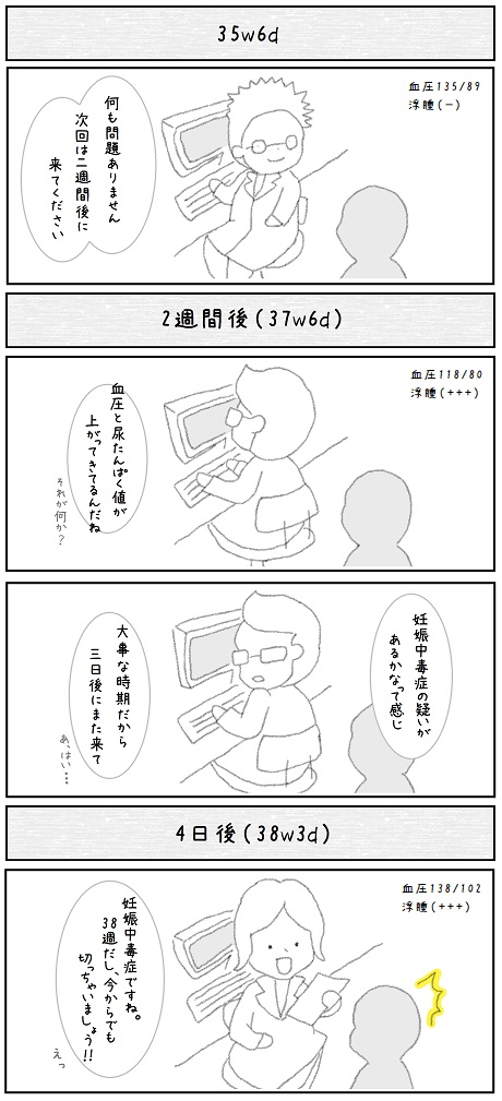 マンガ風 突然の宣告 帝王切開が決まった日の疑問と不安 Yun Mom