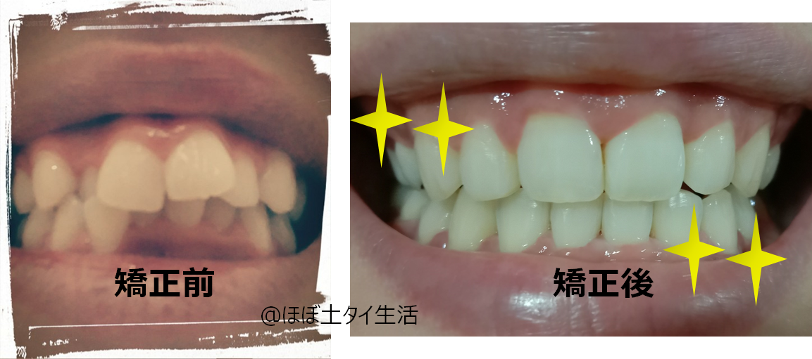 f:id:Manax:20210531184331p:plain
