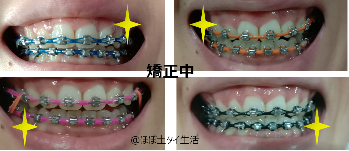 f:id:Manax:20210531184904p:plain