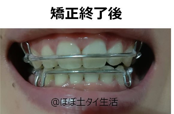 f:id:Manax:20210531184931p:plain