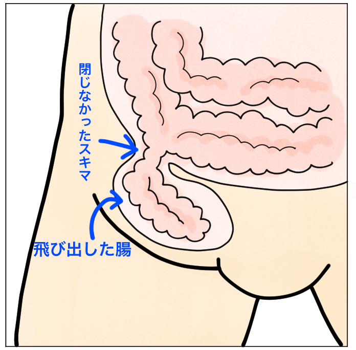f:id:Mariko154:20190614162536j:plain f:id:Mariko154:20190614162536j:plain