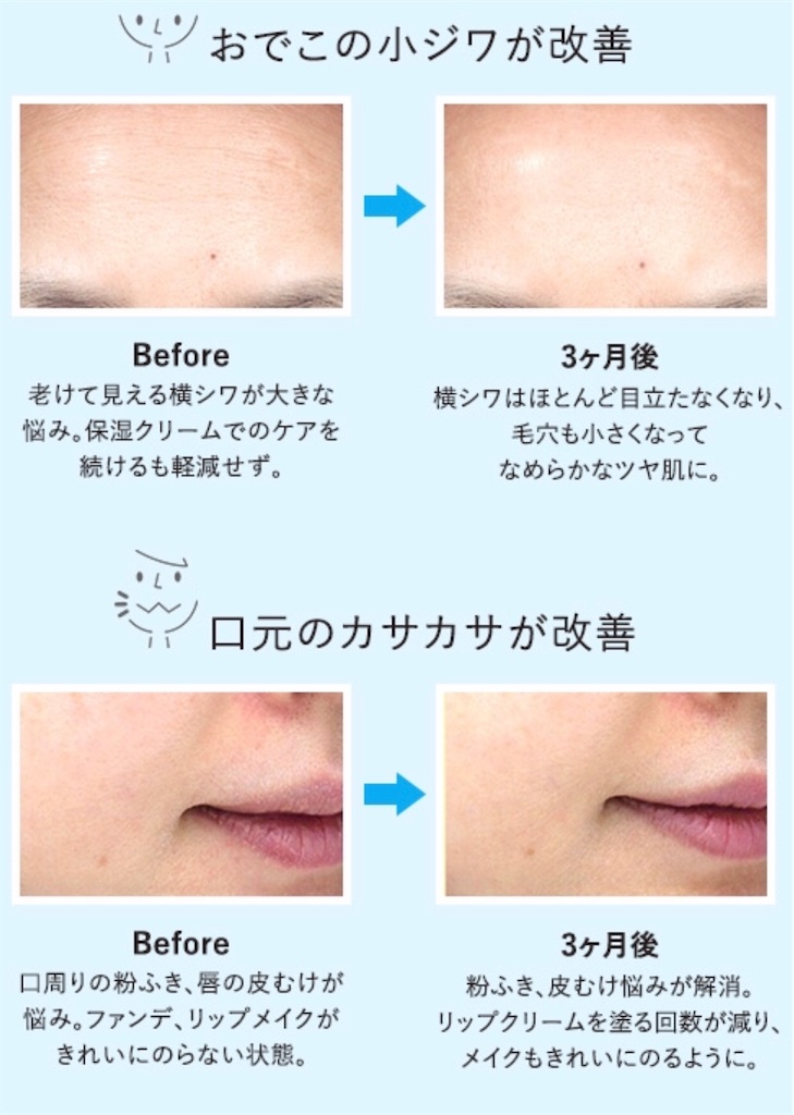 f:id:Mariyogapartoflife:20200130000225j:image