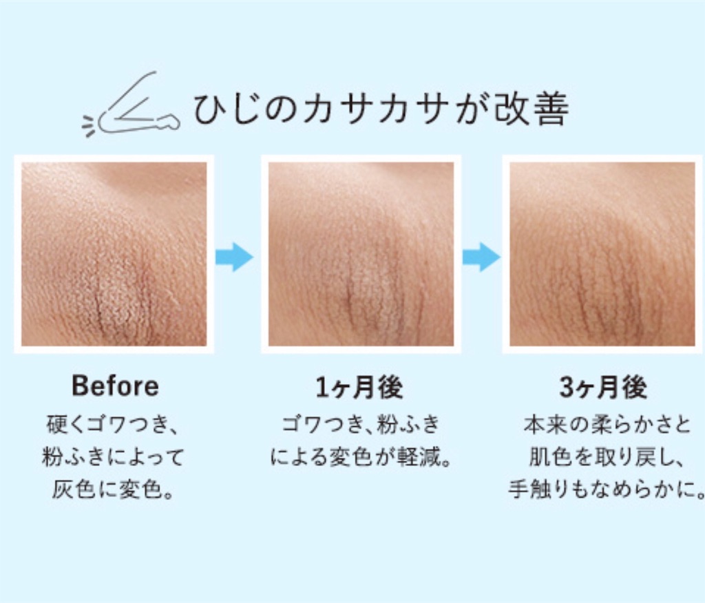 f:id:Mariyogapartoflife:20200130000256j:image