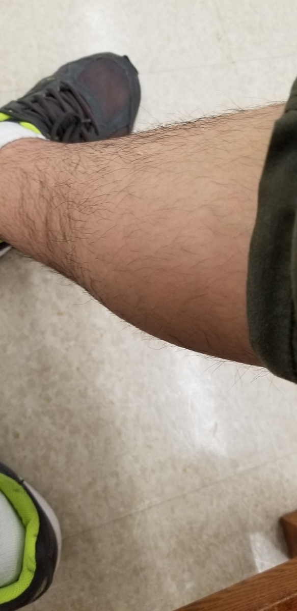 f:id:MetaMon:20190430005645j:plain