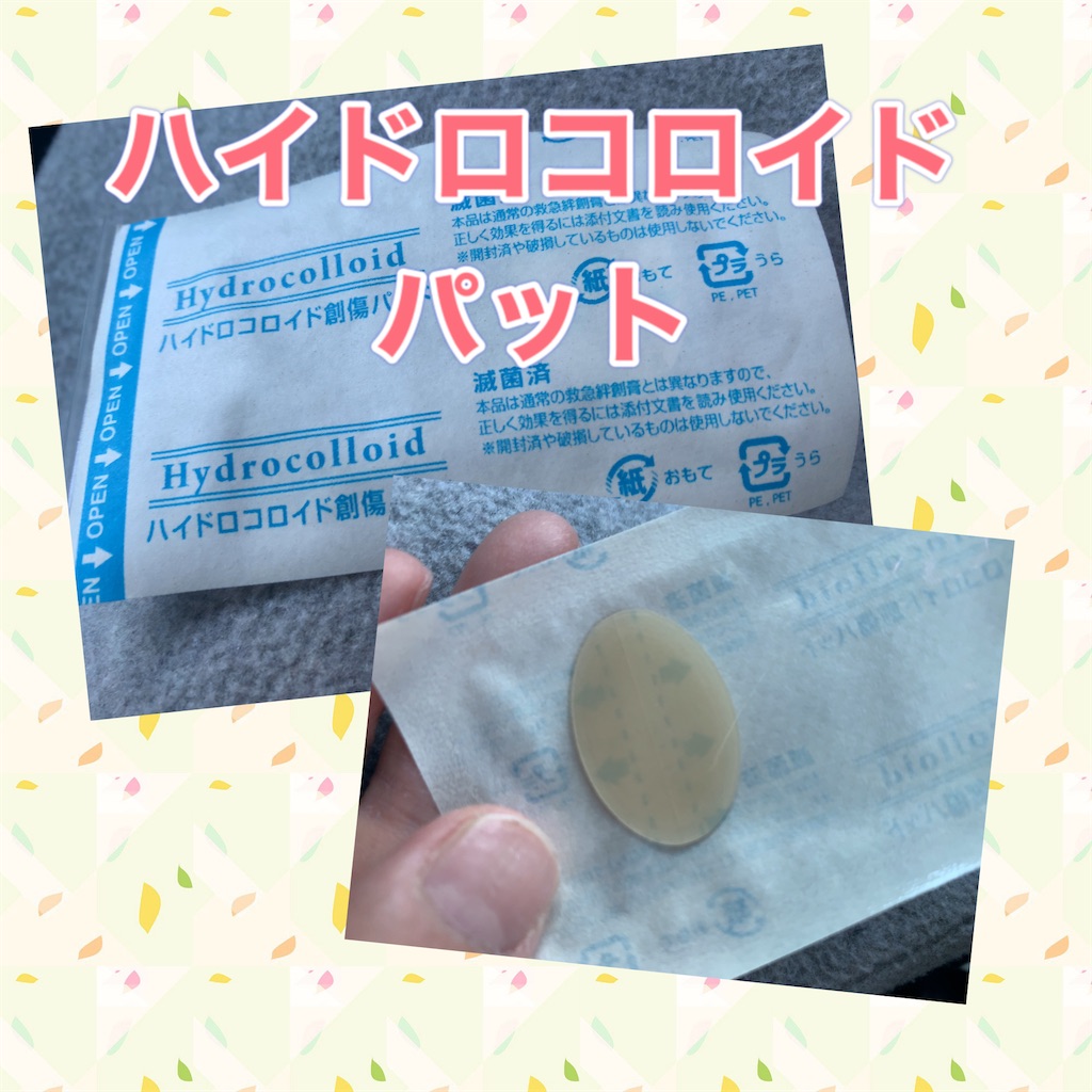 f:id:MiSia:20220226215403j:plain