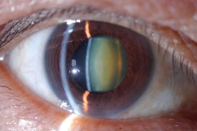 f:id:Mikoe:20200617184202p:plain