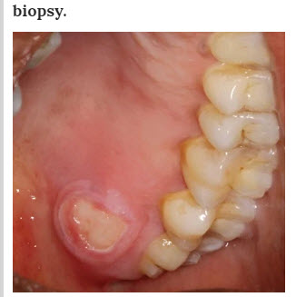 f:id:Mikoe:20200727130630j:plain