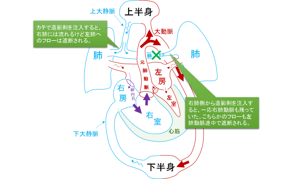 f:id:MoriKen254:20180519120510p:plain f:id:MoriKen254:20180519120510p:plain